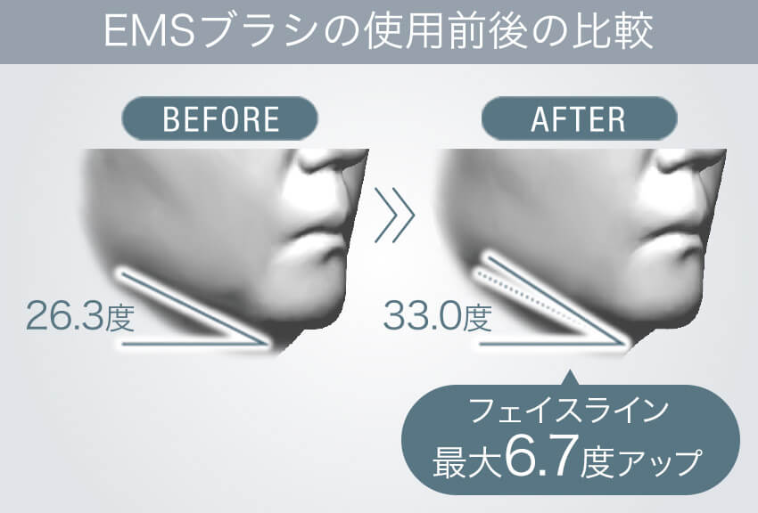 使用前後のフェイスライン比較